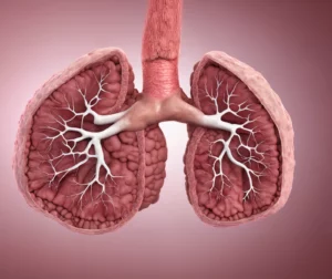 Expert Aspergilloma Surgery in Delhi for Fungal Lung Disease