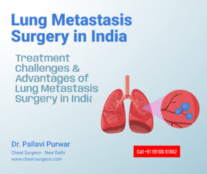 Lung metastasis surgery in India